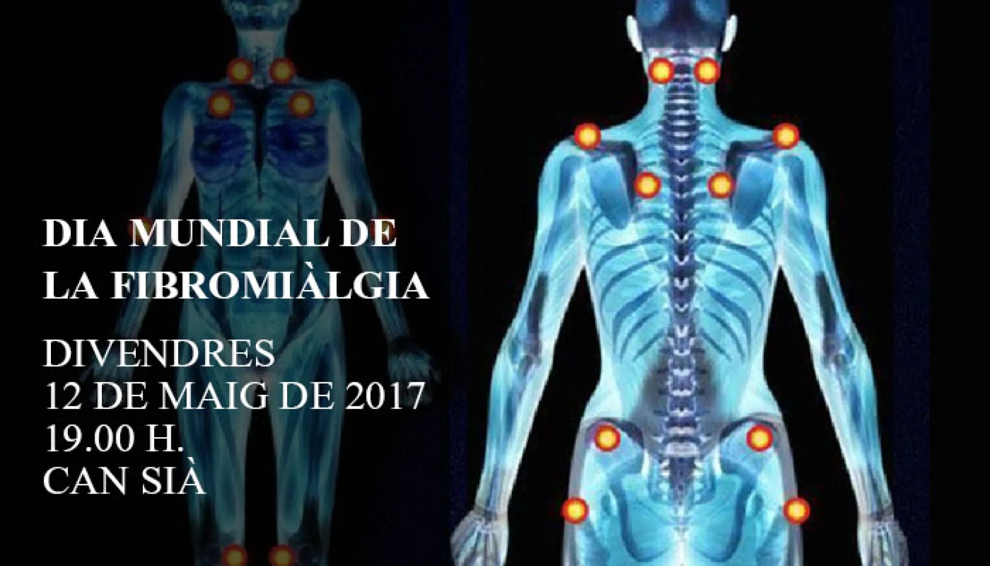 Viladrau Xerrada "La Fibromiàlgia"
